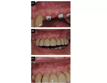 Images showing clinical appearance in relation to test (left in image, region 12) and control (right in image, region 21).