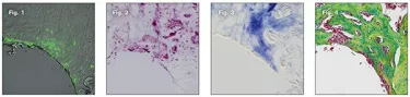  Histology sections of rodent osteotomy site: