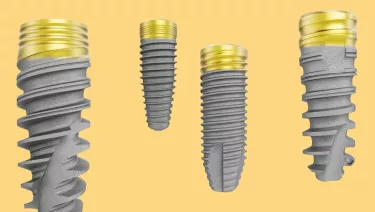 Immediate implants