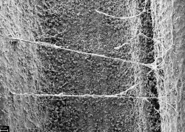 TiUnite osseoconductive surface image