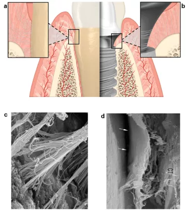 Comparison of periodontium and peri-implant soft tissue characteristics. 