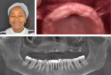 Periodontal examination and face analysis prior to surgery.