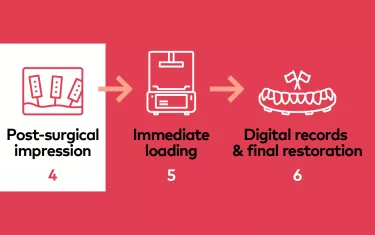 All-on-4® digital workflow
