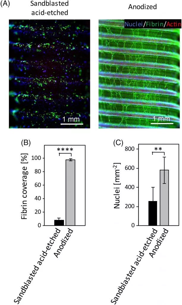 (A) Representative low magnification fluorescence images of stained sandblasted acid‐etched and anodized implants are shown. (B, C) Quantification of fibrin coverage and nuclei present on implant surfaces. Data are mean ± SD (n = 6). ** indicates P < 0.01 and **** indicates P < 0.0001 (Student’s t‐test) Clinical Implant Dentistry and Related Research, Volume: 21, Issue: S1, Pages: 8-14, First published: 28 February 2019, DOI: (10.1111/cid.12737) Figure 2: Quantitative in vitro comparison of the thrombogenic