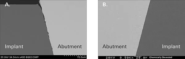 Figure 5. Scanning electron microscopy images of conical connection at 500x magnification (A – to the left). The effect of air particle abrasion cleaning on the fitting surface of an implant abutment is clearly evident (B – to the right). The implant-abutment interface with a new, clean abutment surface for comparison.