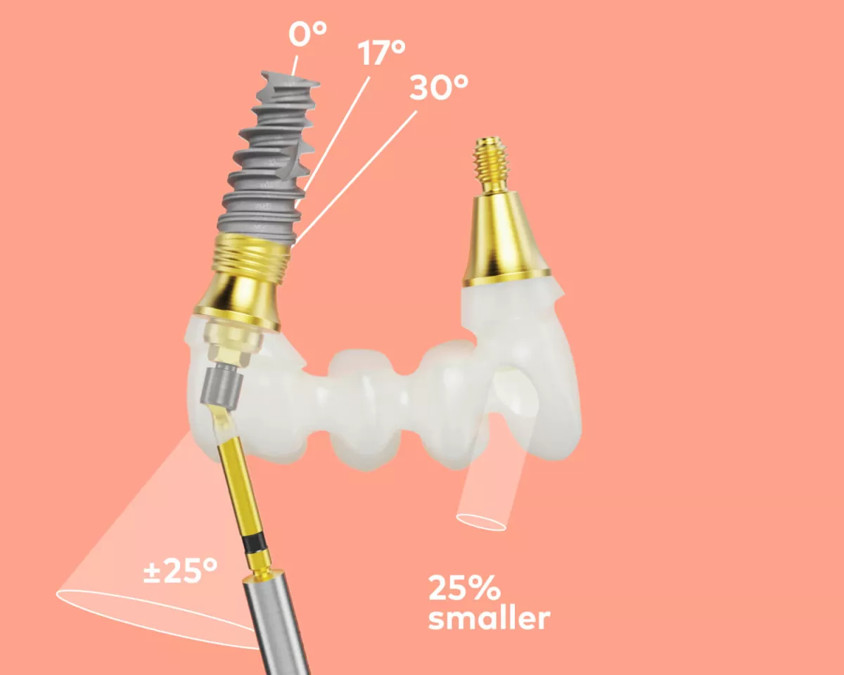 NobelProcera® Zirconia Implant Bridge