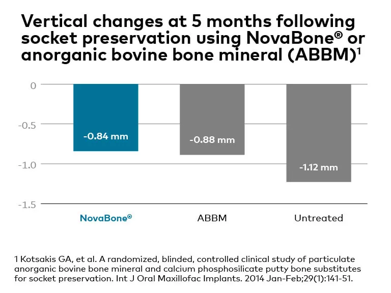 NovaBone® Putty: next-gen synthetic graft