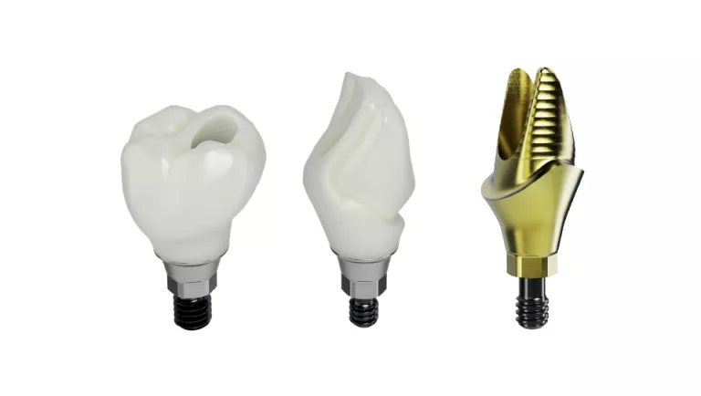 Procera abutments and implant crowns
