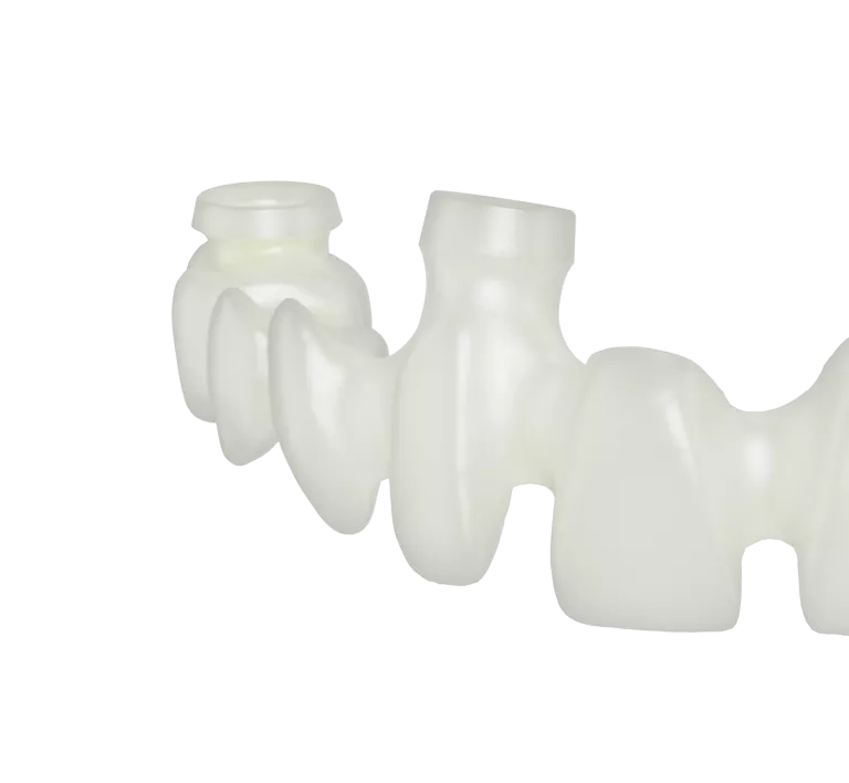 Procera implant bridge