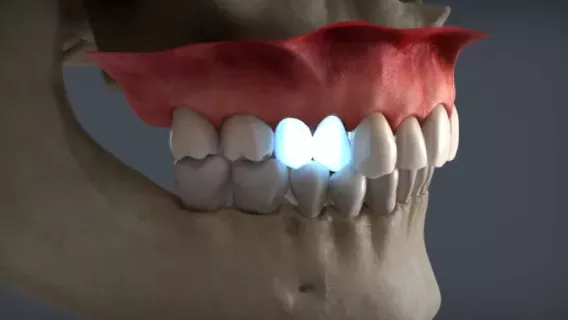 AI-driven tooth setups 