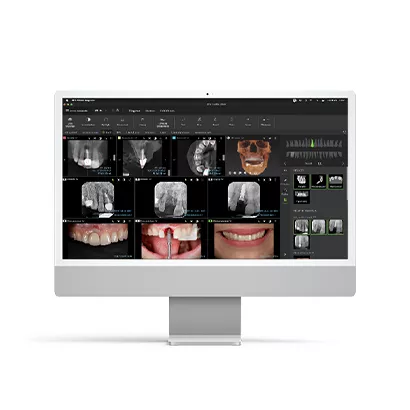 Faster treatment planning with DTX Studio™ Clinic
