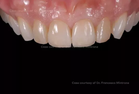 Case courtesy of Dr. Francesco Mintrone
