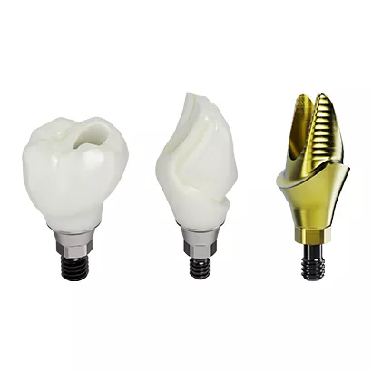 Procera™ restorations