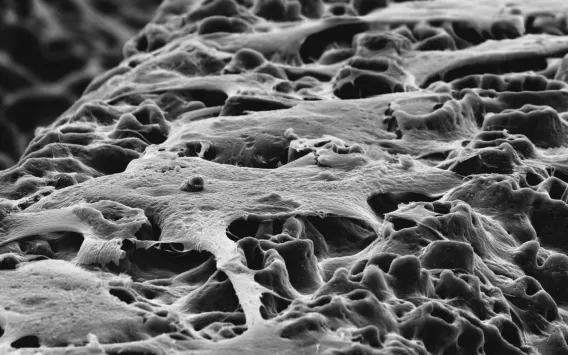 Proven anodized surfaces