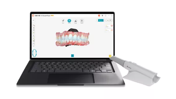 Intraoral scanning with DEXIS™
