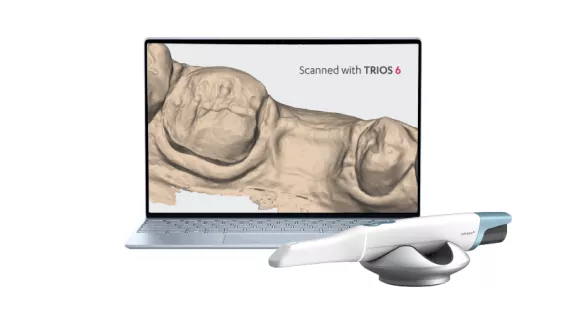 Intraoral scanning with 3Shape TRIOS 6