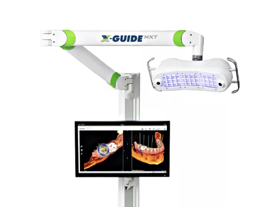 3D dynamic navigation with X-Guide®