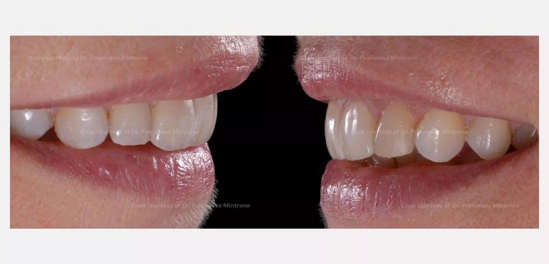 Case courtesy of Dr. Francesco Mintrone