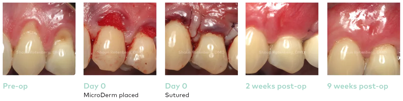 Case courtesy of Dr. Shaun Rotenberg