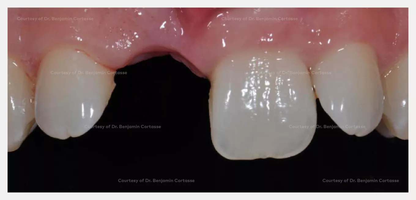 Case courtesy Dr. Benjamin Cortasse