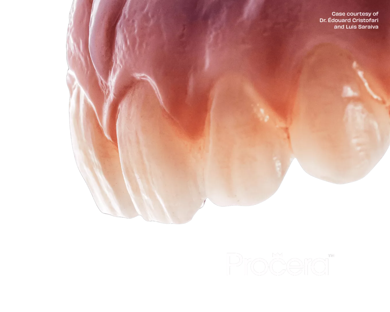 Procera™ restoration
